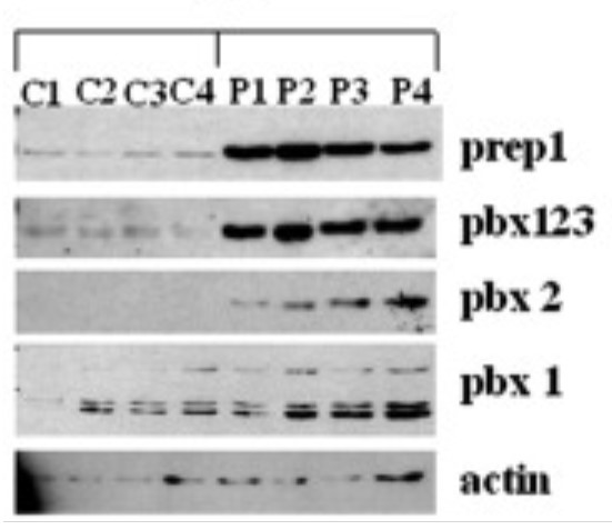 Immunoblotting analysis of PREP-1 and PBX proteins.jpg